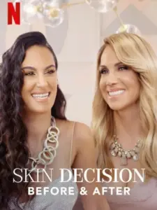 Skindecision: Πριν και Μετά
