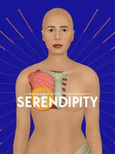 Serendipity