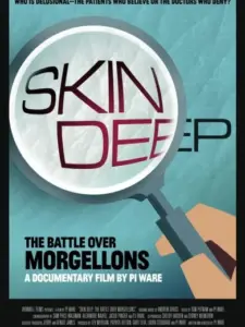 Skin Deep: The Battle Over Morgellons
